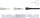 BGS Motor-Einstellwerkzeug-Satz | für Ford | 4-tlg.